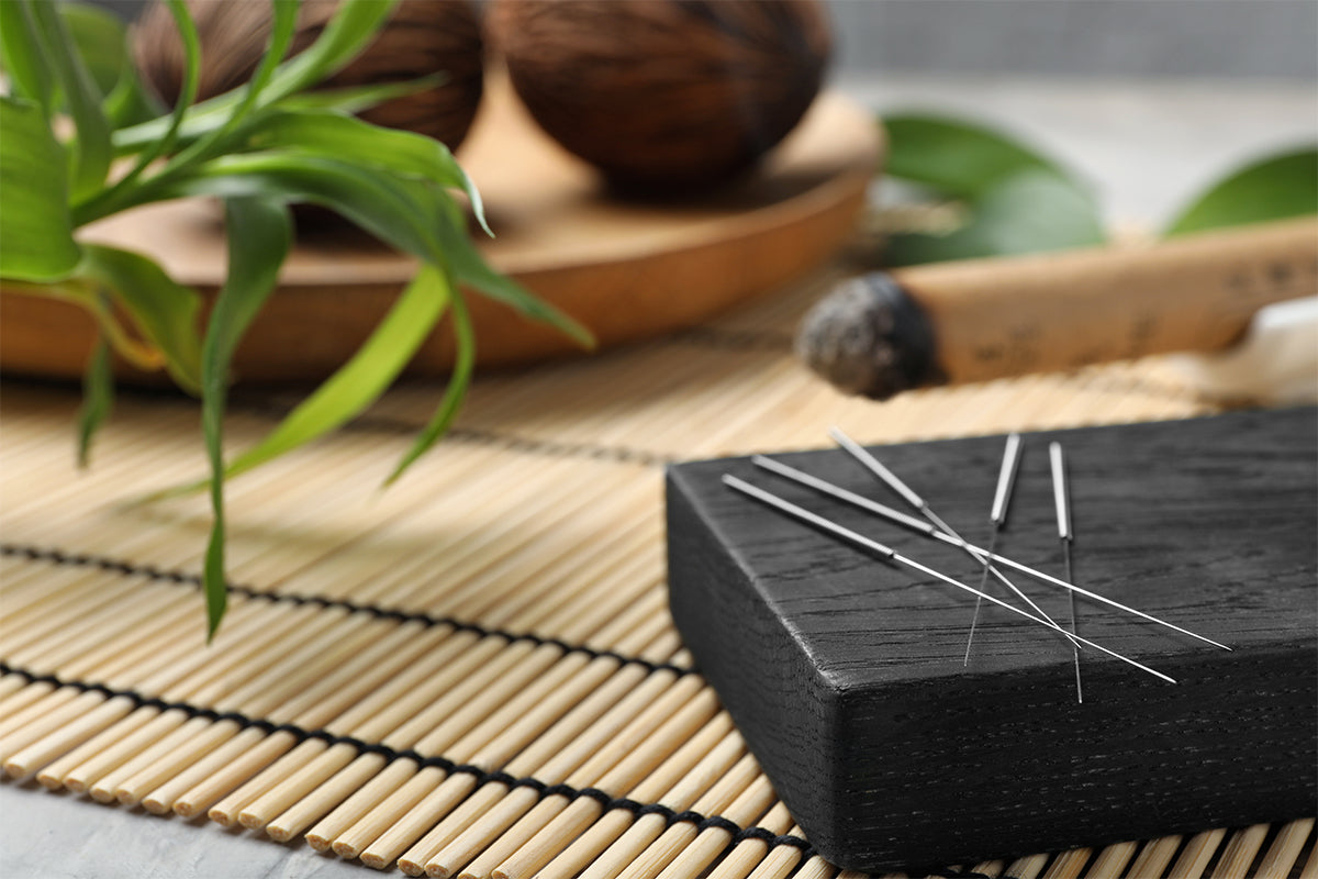什么是针灸?如何使用它? - Best In Nature