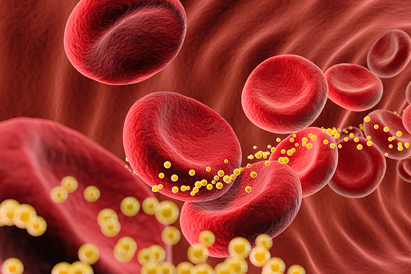 Blood Cholesterol CoQ10